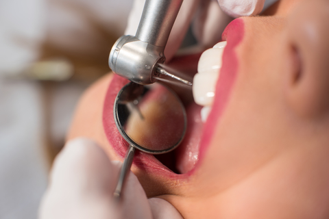 female cosmetic dentistry patient receiving treatment